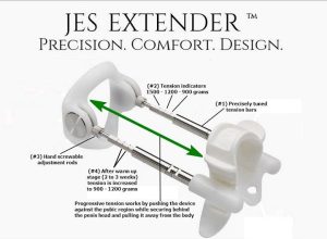 JES Extender
