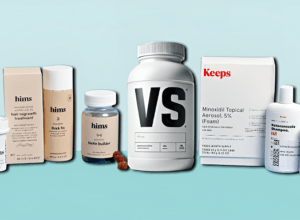 Comparing Hims and Keeps: Which Hair Loss Treatment is Right for You?